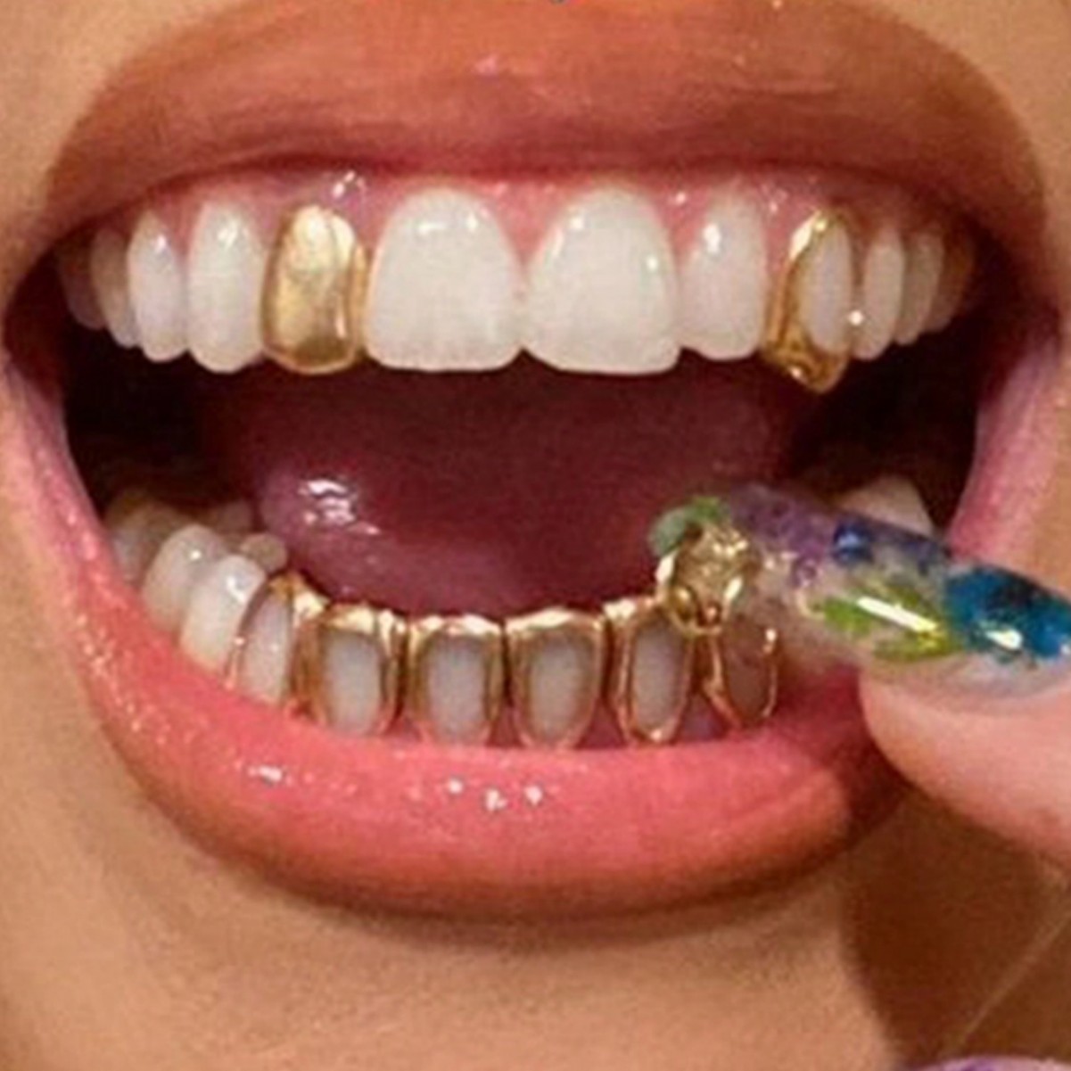 Offre Spéciale : Appareil Dent - Body Jewelry Hot avis et prix